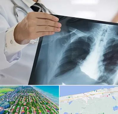 فوق تخصص ریه در فریدونکنار