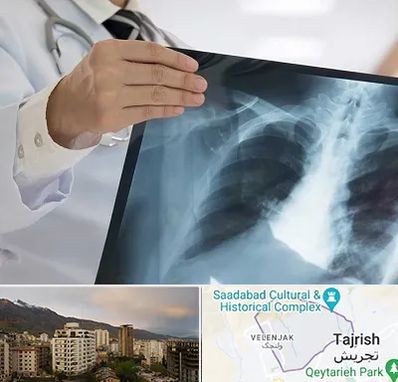 فوق تخصص ریه در زعفرانیه 