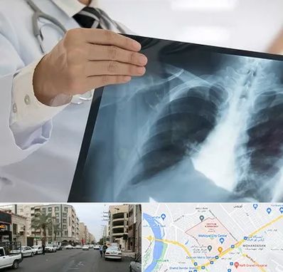 فوق تخصص ریه در زیتون کارمندی اهواز