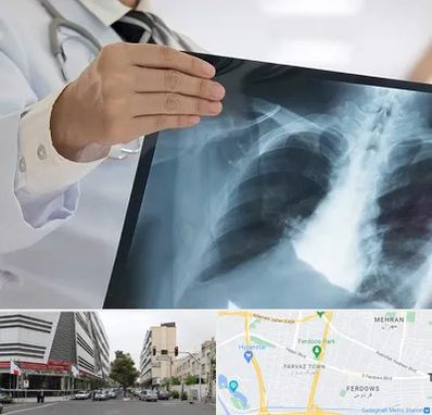 فوق تخصص ریه در بلوار فردوس 