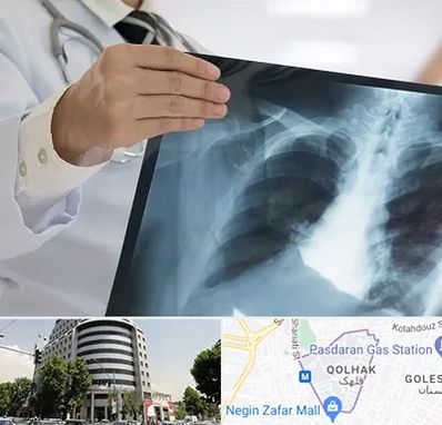 فوق تخصص ریه در قلهک 