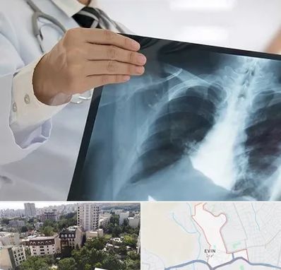 فوق تخصص ریه در اوین