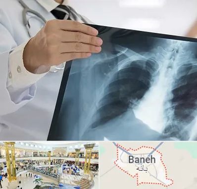 فوق تخصص ریه در بانه