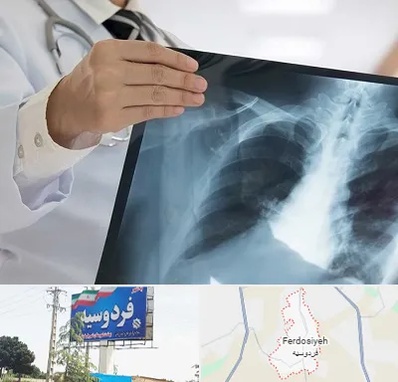 فوق تخصص ریه در فردوسیه شهریار