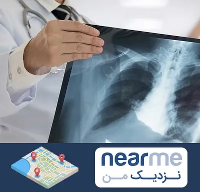 فوق تخصص ریه در نزدیک من