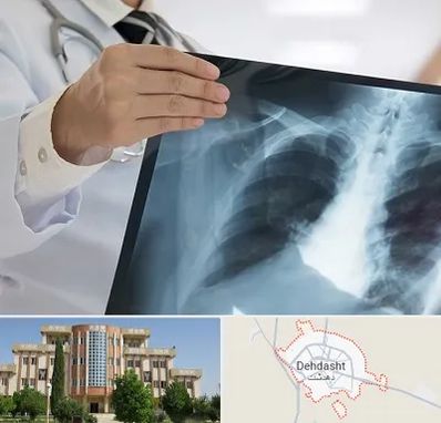 فوق تخصص ریه در دهدشت