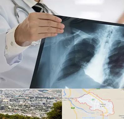 فوق تخصص ریه در یاسوج