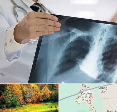 فوق تخصص ریه در کردکوی