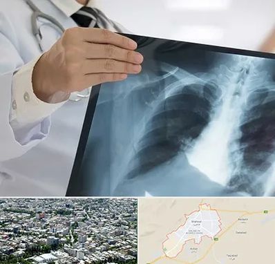 فوق تخصص ریه در شاهرود