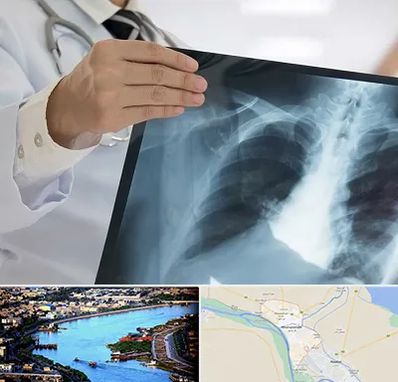 فوق تخصص ریه در خرمشهر