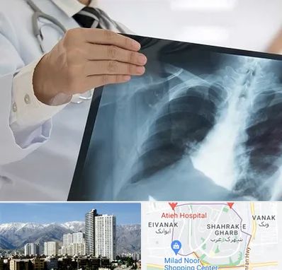 فوق تخصص ریه در شهرک غرب 