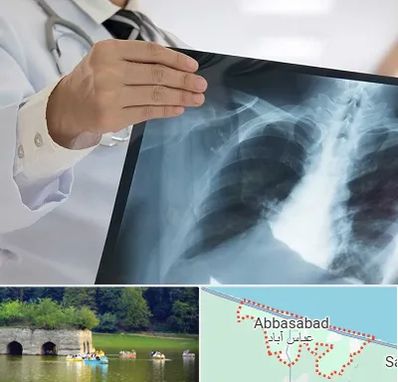 فوق تخصص ریه در عباس آباد