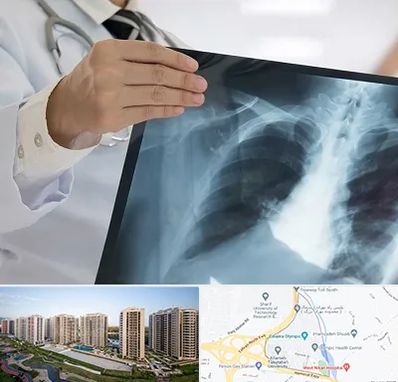 فوق تخصص ریه در المپیک 