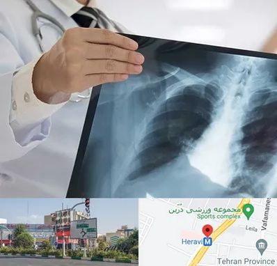 فوق تخصص ریه در هروی 