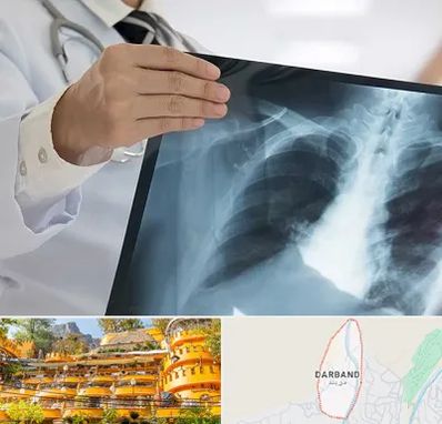 فوق تخصص ریه در دربند