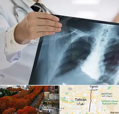 فوق تخصص ریه در ولیعصر 