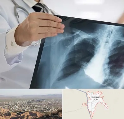 فوق تخصص ریه در اسفراین