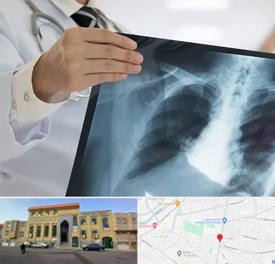 فوق تخصص ریه در زنبیل آباد قم