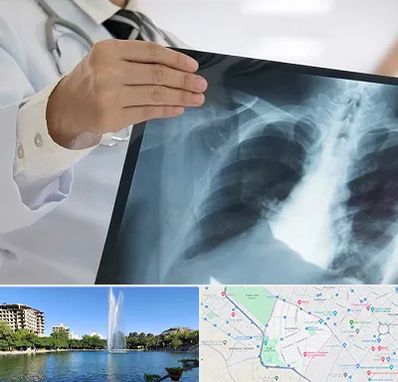 فوق تخصص ریه در کوهسنگی مشهد