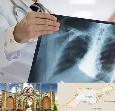 فوق تخصص ریه در سمنان