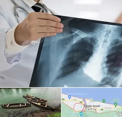 فوق تخصص ریه در بندر انزلی