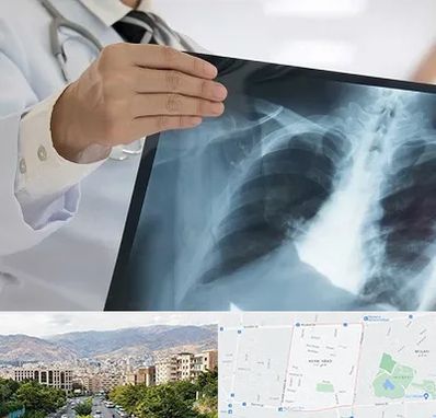 فوق تخصص ریه در خانی آباد