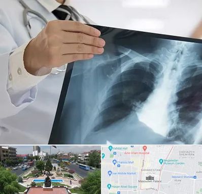 فوق تخصص ریه در بهارستان 