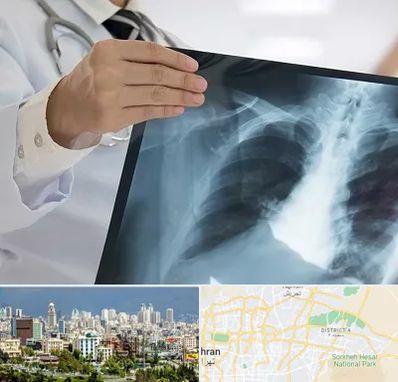 فوق تخصص ریه در شرق تهران 
