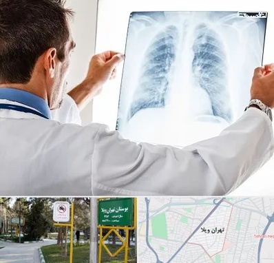 دکتر متخصص ریه در تهران ویلا