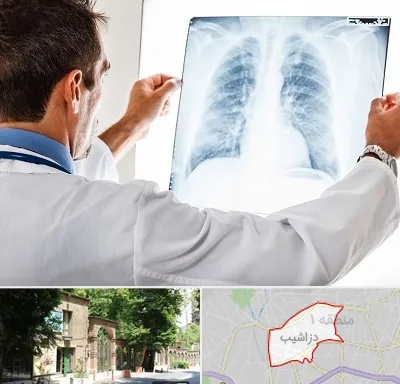 دکتر متخصص ریه در دزاشیب