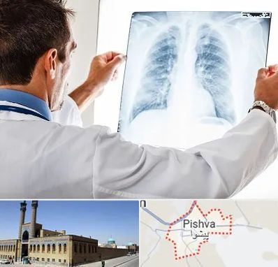 دکتر متخصص ریه در پیشوا