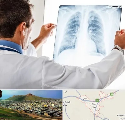 دکتر متخصص ریه در بیجار