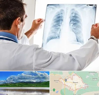 دکتر متخصص ریه در مرند