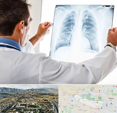 دکتر متخصص ریه در منطقه 21 تهران 