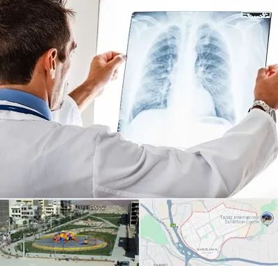 دکتر متخصص ریه در مرزداران تبریز