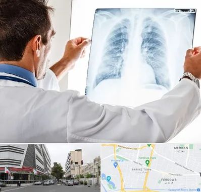 دکتر متخصص ریه در بلوار فردوس 