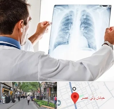 دکتر متخصص ریه در ولیعصر شهریار