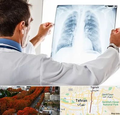 دکتر متخصص ریه در ولیعصر 
