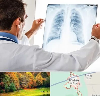 دکتر متخصص ریه در کردکوی
