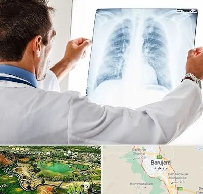 دکتر متخصص ریه در بروجرد