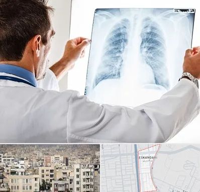 دکتر متخصص ریه در اسکندری