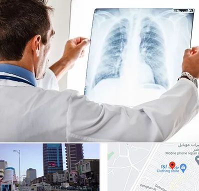 دکتر متخصص ریه در چهارراه طالقانی کرج