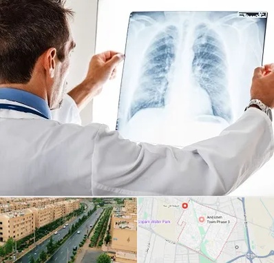 دکتر متخصص ریه در فاز سه اندیشه