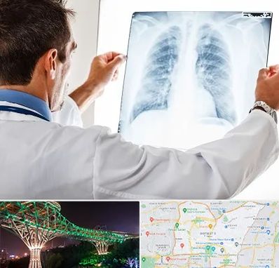 دکتر متخصص ریه در منطقه 3 تهران 