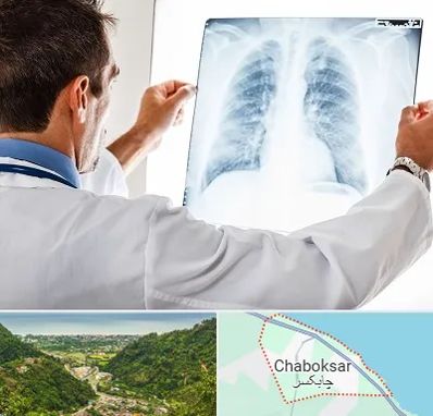دکتر متخصص ریه در چابکسر