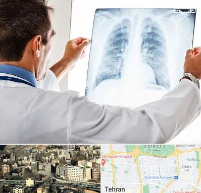 دکتر متخصص ریه در مرزداران 