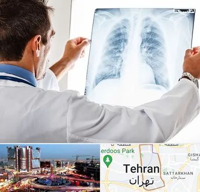 دکتر متخصص ریه در صادقیه 