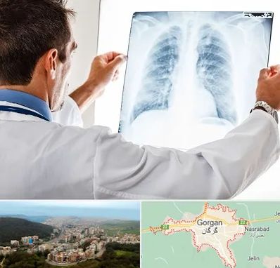 دکتر متخصص ریه در گرگان