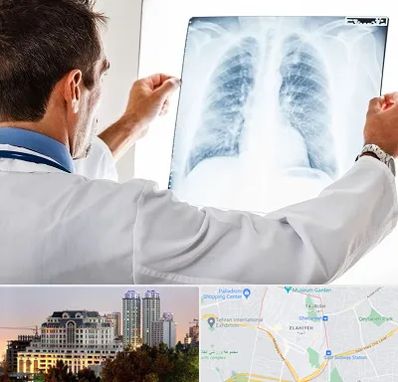 دکتر متخصص ریه در فرشته 