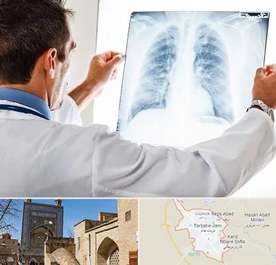 دکتر متخصص ریه در تربت جام